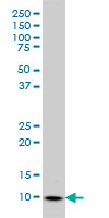 WB - S100A6 Antibody (monoclonal) (M10) AT3759a